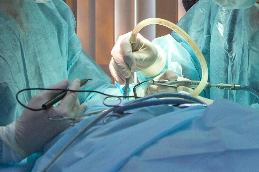 Нижегородские хирурги провели уникальную операцию по удалению саркомы бедра