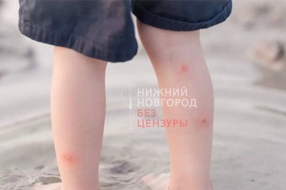 Черви церкарии обнаружены в озере Земснаряд в Автозаводском районе