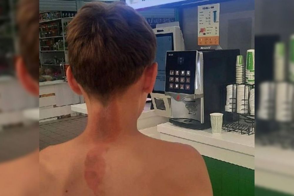 Охранник супермаркета облил 13-летнего ребенка кипятком в Нижнем Новгороде